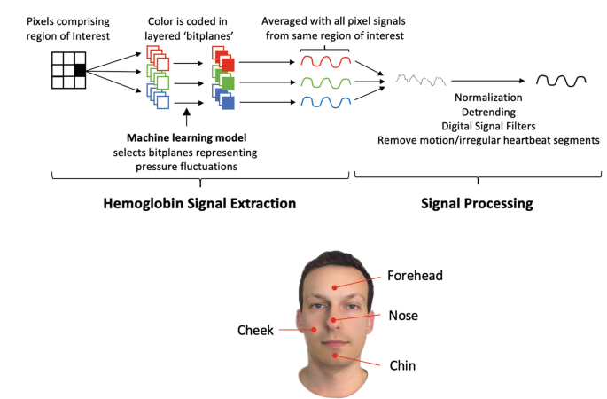 Signal extraction and processing Signal extraction and processing