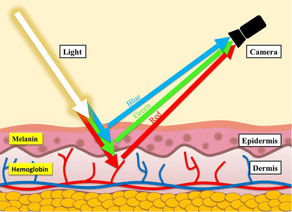 Transdermal optical imaging Transdermal optical imaging